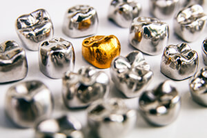 Sell dental gold